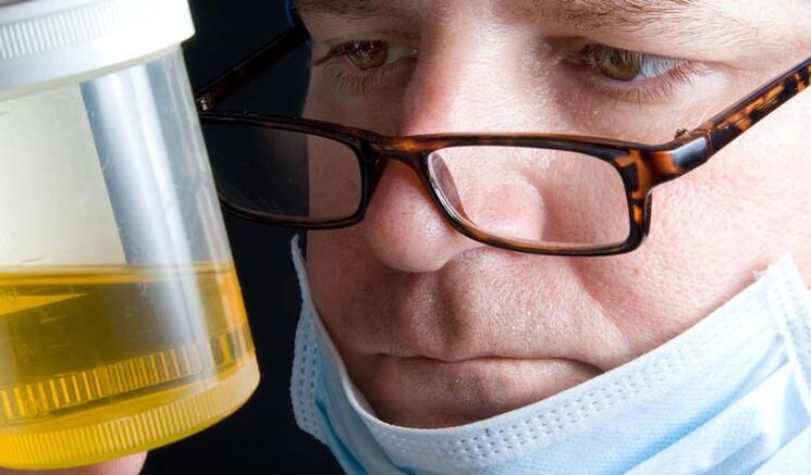 analiza moczu na przewlekłe zapalenie gruczołu krokowego